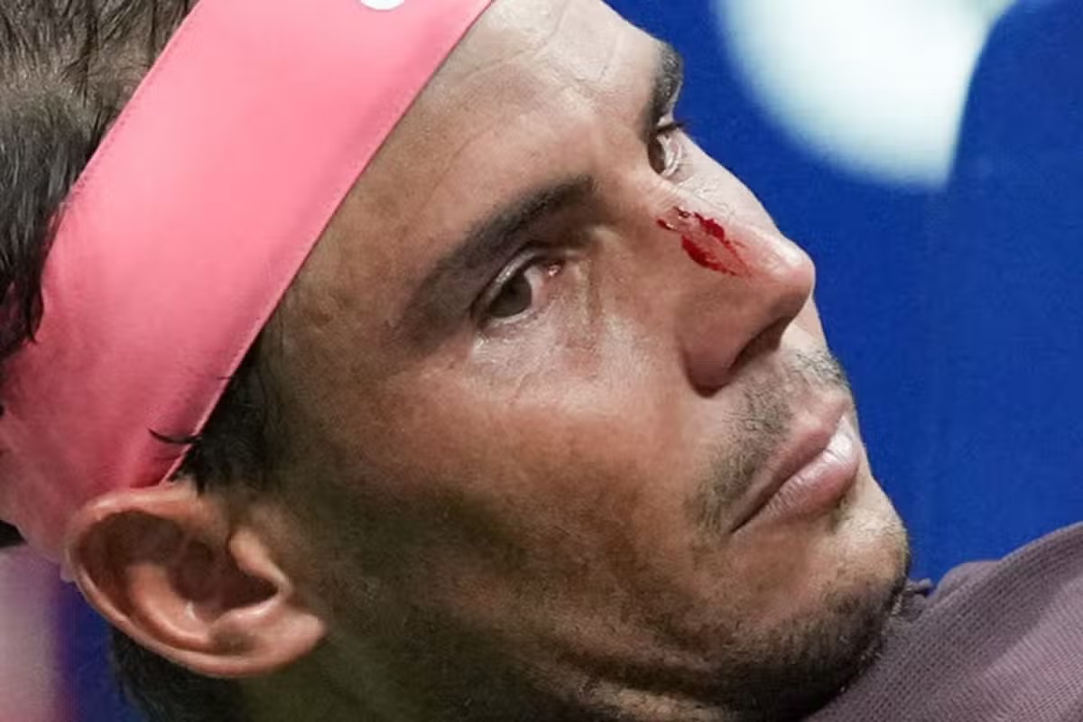 SAD NEWS play: Nadal Rafael sustain a brutal injury and he will not play again till December ends
